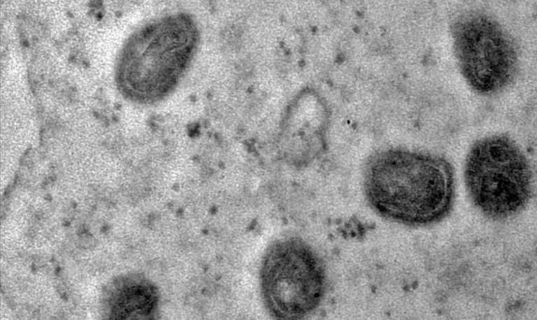 monkeypox_03-1152×689.jpg-768×459